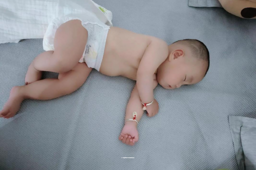 石家庄六个月宝宝眼睛散光 石家庄六个月宝宝眼睛散光